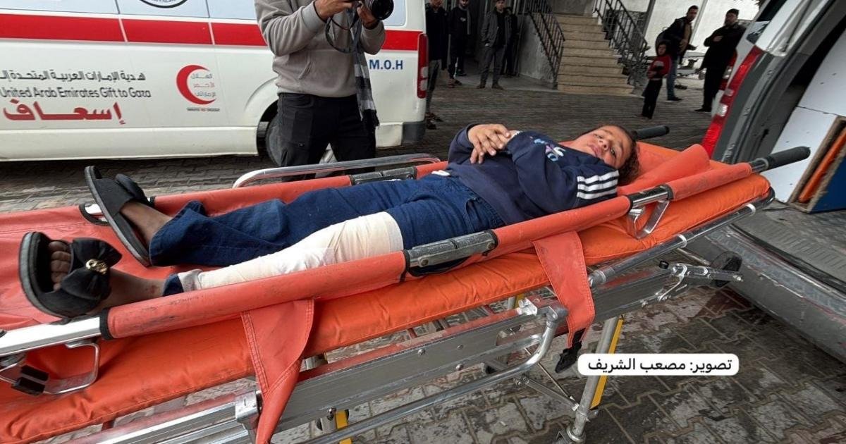 إصابة 3 فلسطينيين بينهم طفلة شرق مدينة حمد بخان يونس