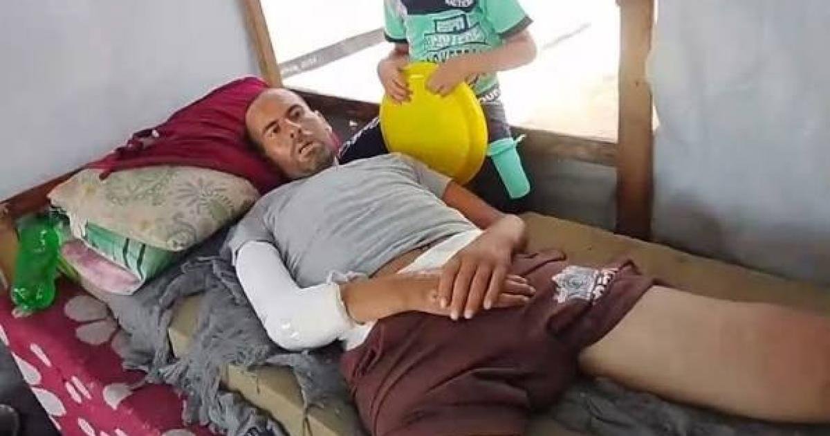 جريح غزة أسامة برهم يواجه خطر بتر ساقه بانتظار الإخلاء الطبي
