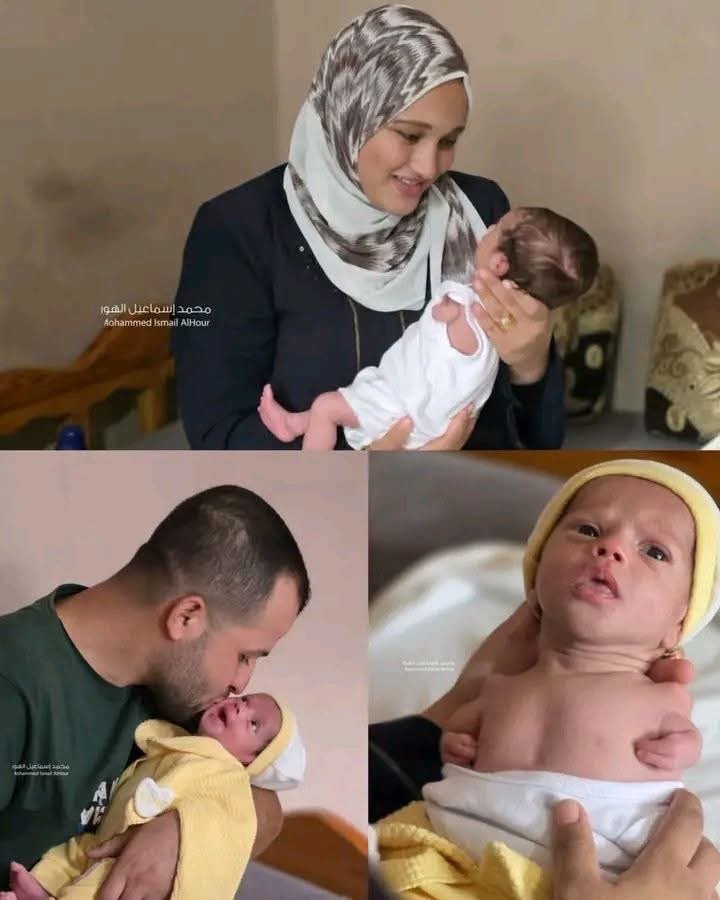 نورا.. طفلة غزّة التي وُلدت بلا كفّين بعد 4 سنوات من انتظار الأمومة